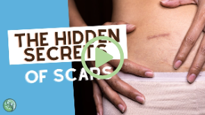 Link to video titled “The Hidden Secrets of Scars“